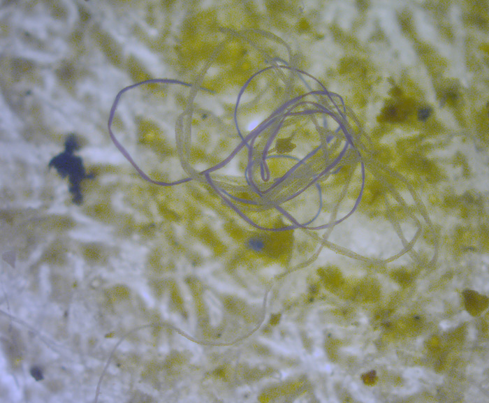  Gözle görülemeyen boyutlardaki mikroplastik parçacıklar özellikle deniz canlılarını tehdit ediyor.